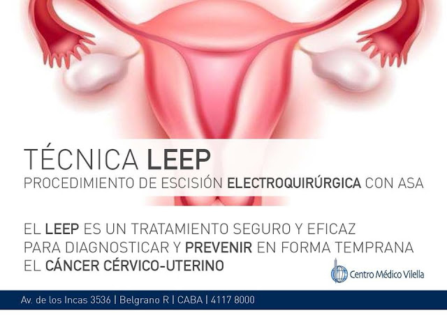 Técnica Leep
