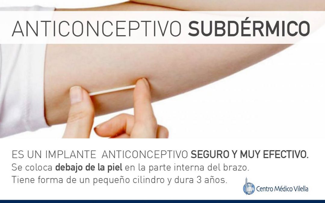 Anticonceptivo Subdérmico con implante