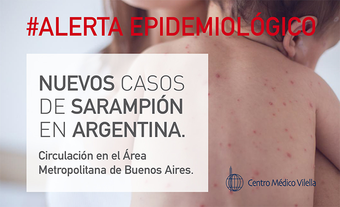 SARAMPIÓN | Alerta epidemiológico